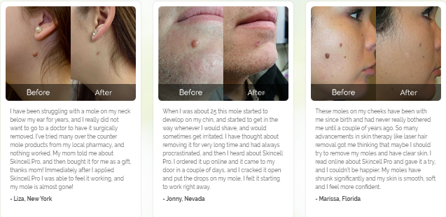 Skincell Pro Results